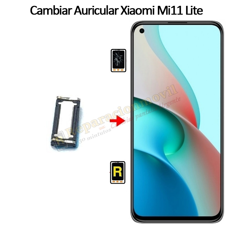 Cambiar Auricular De Llamada Xiaomi Mi 11 Lite 4G